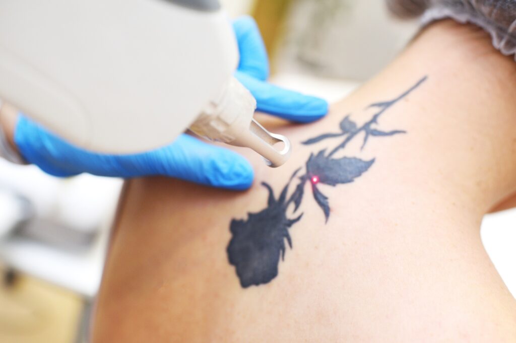 Precision Ink Removal